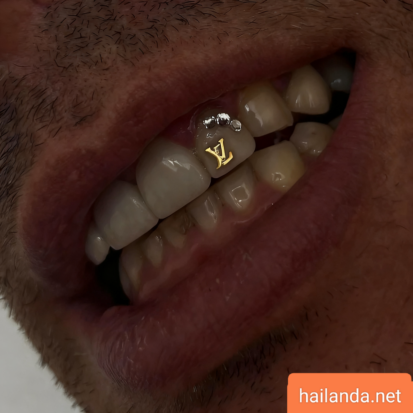 VL Tooth Gem